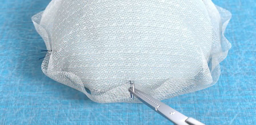 BD’s Breast Revision Trial for Capsular Contracture Reaches First Interim Analysis