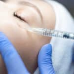 FDA Approves RHA Redensity Eye for Infraorbital Volume Deficiencies