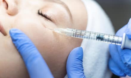 FDA Approves RHA Redensity Eye for Infraorbital Volume Deficiencies