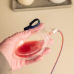 Surgical Drains Do Not Reduce Complications After Breast Reduction, Study Finds