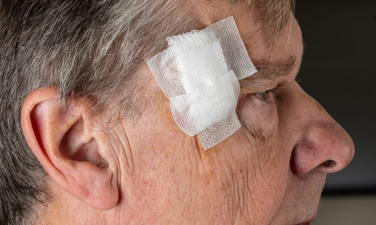 Could a Growth Factor Help Complex Wounds Heal Faster After Skin Cancer Surgery?