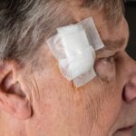 Could a Growth Factor Help Complex Wounds Heal Faster After Skin Cancer Surgery?