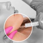 Phase 3 Trial Shows Injectable Treatment Reduces Submental Fat