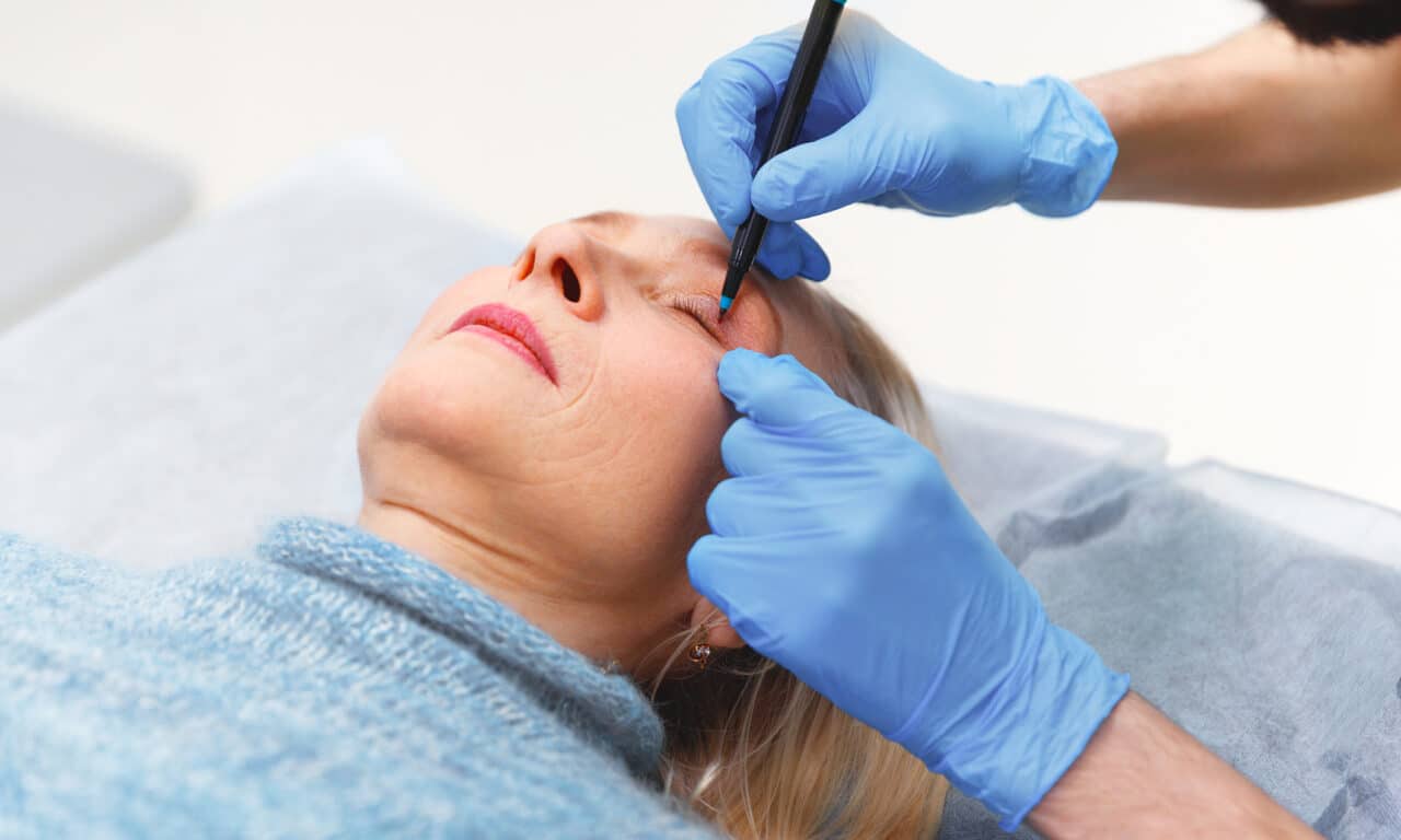 The Younger Facelift Patient in the GLP-1 Era